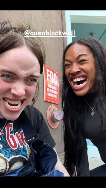 🔥 Billie eilish  page leaked private photo uncensored full