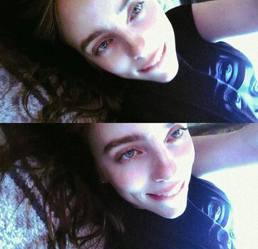 🔥 Billie eilish  page leaked private photo uncensored full