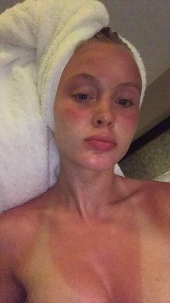 🔥 Zara larsson  page leaked private photo uncensored full
