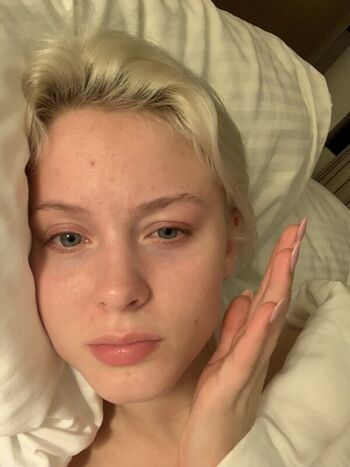 🔥 Zara larsson  page leaked private photo uncensored full